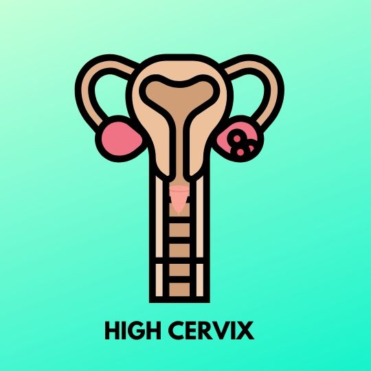 high cervix with menstrual cup