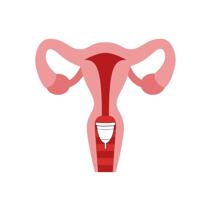 menstrual cup with a high cervix